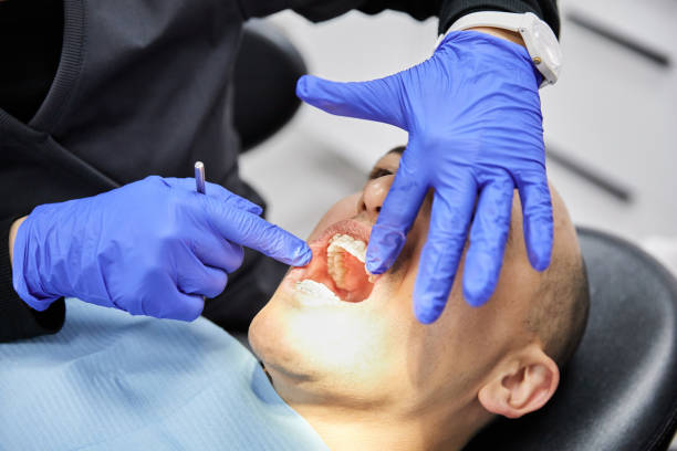 Best Emergency Treatment for Dental Infections or Abscesses in Milton, WV
